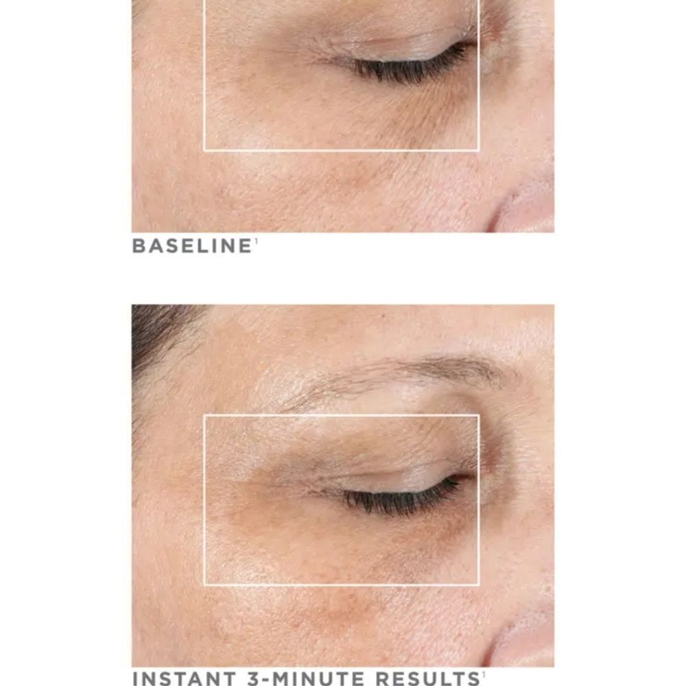 NuFace‎ Fix Line Smoothing Device - Picture 7 of 12